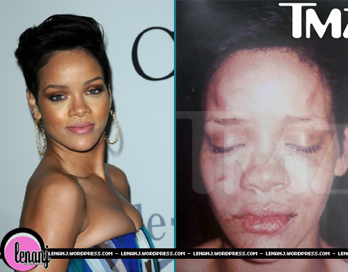 Should Rihanna forgive Chris Brown for beating her up? rihanna face beat up.